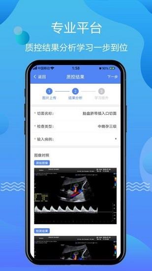 超声智库  v1.0.9图4