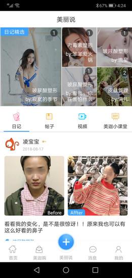 美迦  v1.0.17图1