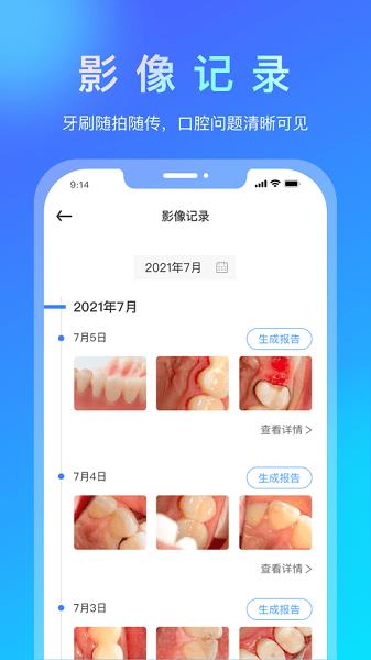 悦牙云  v1.0图3